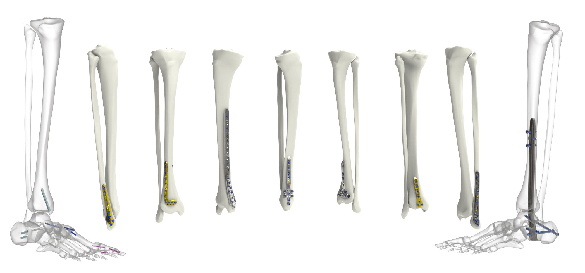 TST Medical Devices